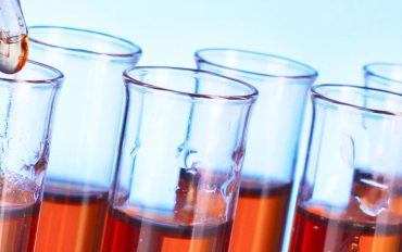 The Reasons Why You Might Need Regular Blood Tests